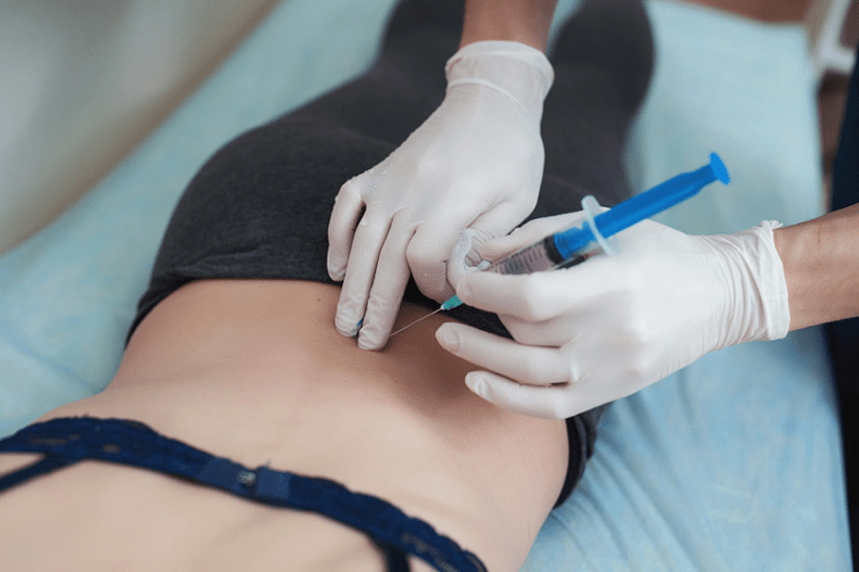 blockade in lumbar osteochondrosis