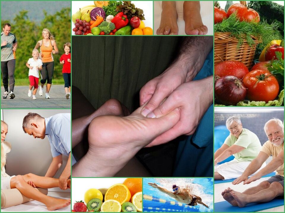 Arthrosis of the knee joint prevention